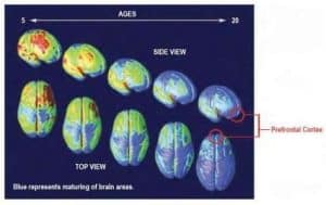 Teen Brain Scans